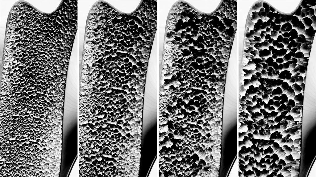 Stage 4 Osteoporosis T-Score: Quick Answers & Next Steps