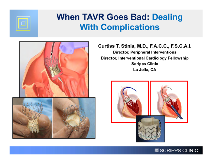 tavr complications – the big five you need to know
